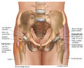 Bursitis and Osteoarthritis of the Hip