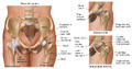 Osteoarthritis and Rheumatoid Arthritis of the Hip