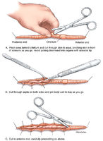 Earthworm Dissection