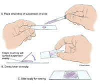 Wet Mount Slide Technique