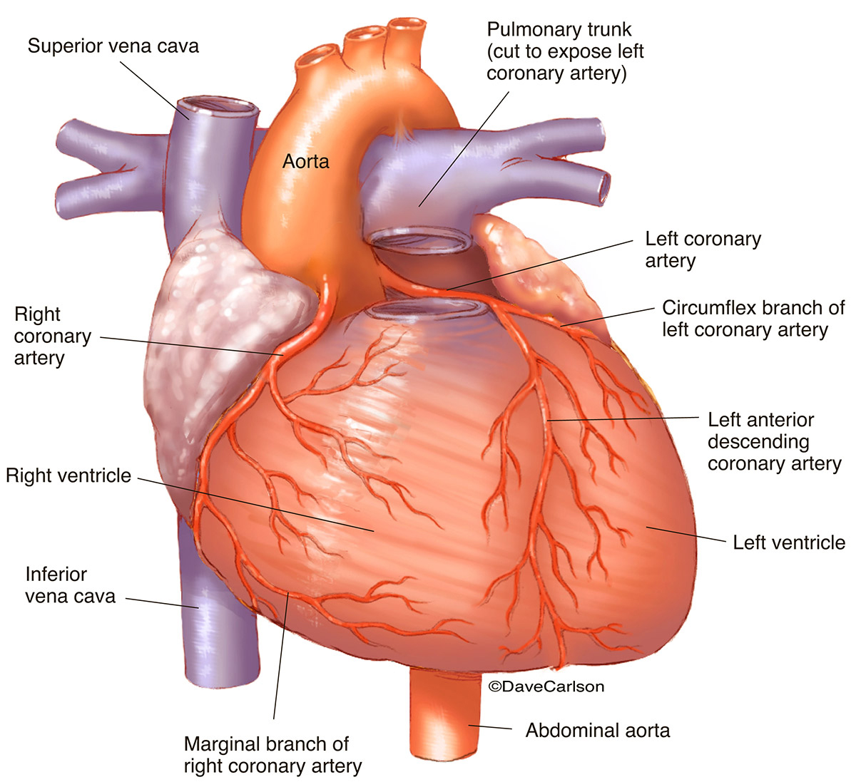 Illustration of the coronary arteries on the frontside of the heart.