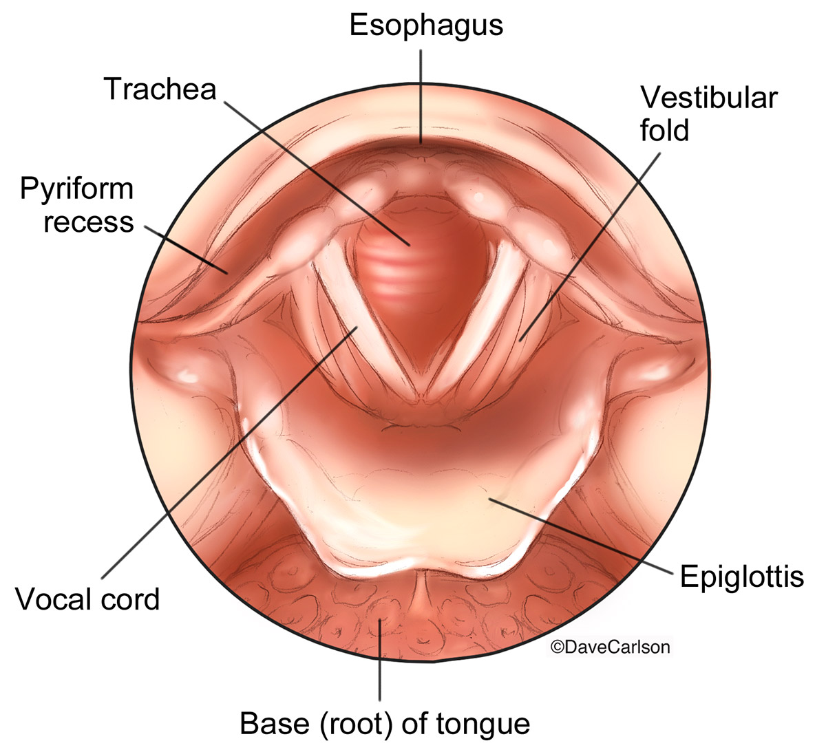 Illustration of the structures of the larynx as viewed through a laryngosope.