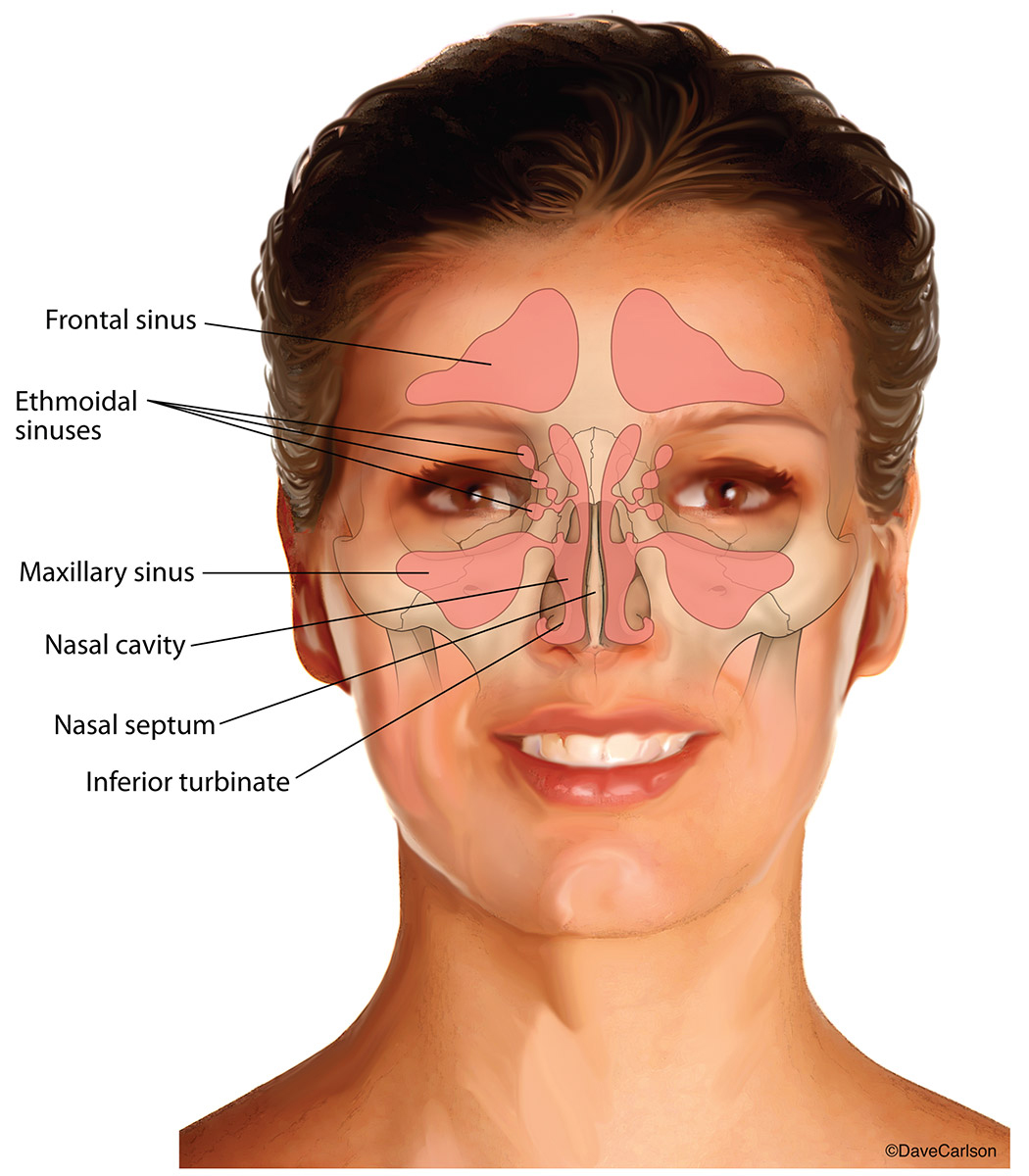 Illustration showing the nasal sinuses located within the front of the skull.